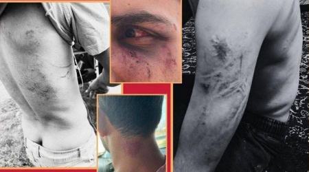 حمله به گردشگران در اوپرت،اخبار اجتماعی،خبرهای اجتماعی