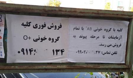 خرید و فروش اعضای بدن در ایران،اخبار اجتماعی،خبرهای اجتماعی