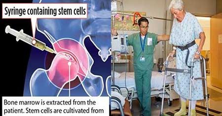 اخبار,اخبار علمی ,ترمیم مفصل استخوان ران اخبار,اخبار علمی ,ترمیم مفصل استخوان ران