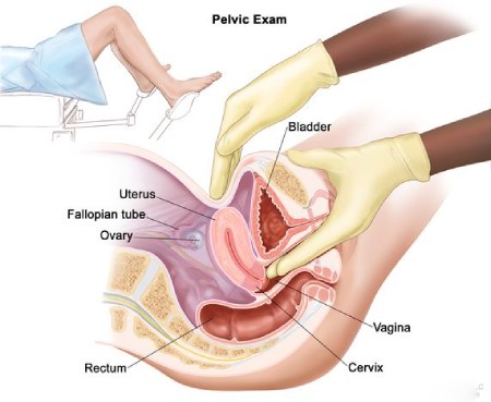 آزمایشات مناسب برای بررسی واژن