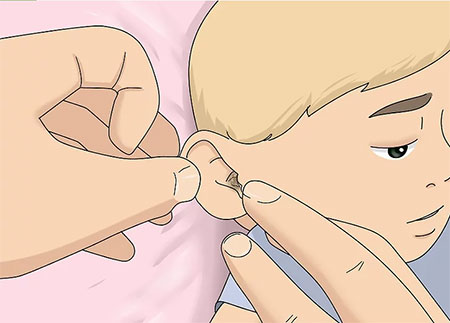 تمیز کردن گوش نوزادان,آموزش تصویری تمیز کردن گوش نوزادان