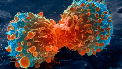 تاثیر عفونت ها در بروز سرطان, علل بروز سرطان رحم