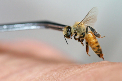 درمان زنبورزدگی, خطرات زنبورزدگی
