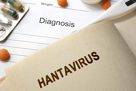 علایم هانتا ویروس, نشانه های هانتا ویروس