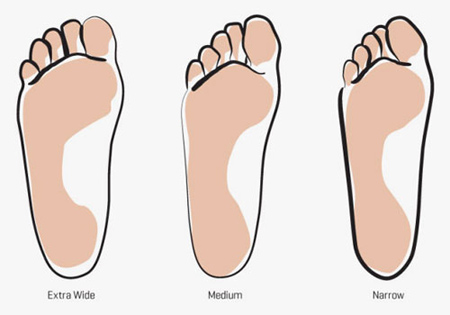 راهنمای انتخاب کفش های مناسب پا, کفش های مناسب فرم های پا
