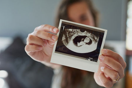 تنبلی در بارداری و جنسیت جنین, تشخیص جنسیت جنین از روی ناف مادر, تعیین جنسیت با دمای شکم